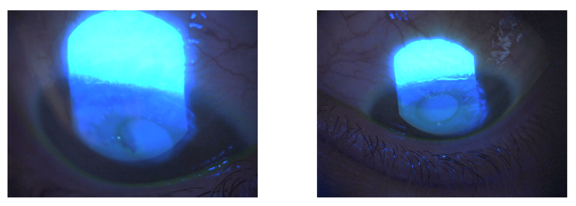 Figure 3 FLUO